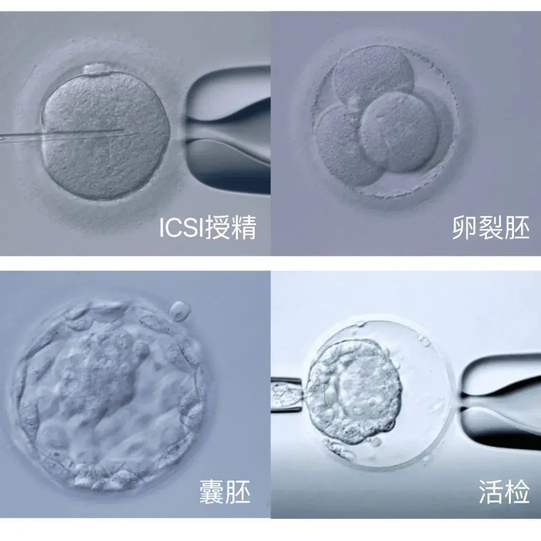 三代试管婴儿流程_试管婴儿和正常孩子一样吗_三代试管婴儿全流程详解