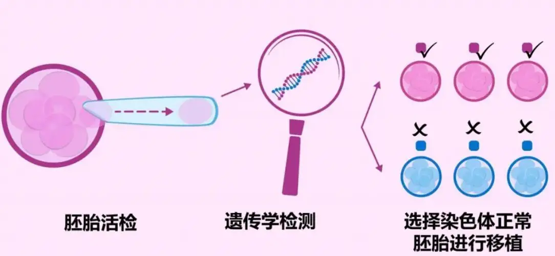 三代试管婴儿全流程详解_三代试管婴儿流程_试管婴儿和正常孩子一样吗